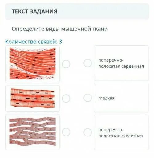 Изображение поперечно полосатой скелетной мышечной ткани. Поперечно Скелетная мышечная ткань. Скелетная и сердечная ткань. Поперечная полосатая Скелетная мышечная ткань. Виды скелетно поперечно-полосатые мышечные ткани.