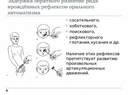 Дцп симптомы