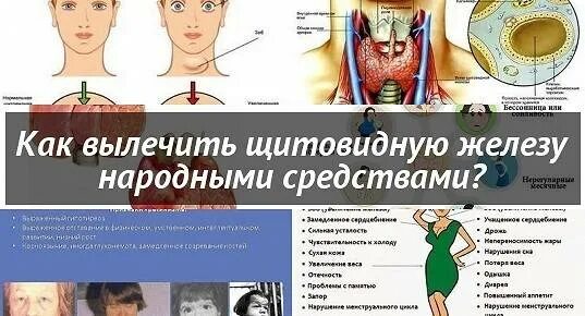 Как вылечить желез. Народные методы щитовидная железа. излечение щитовидной железы. как подлечить щитовидную железу. как лечить щитовидной железы у женщин.