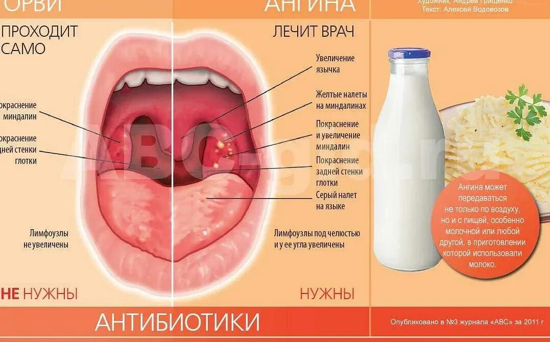 Чем лечить горло быстро