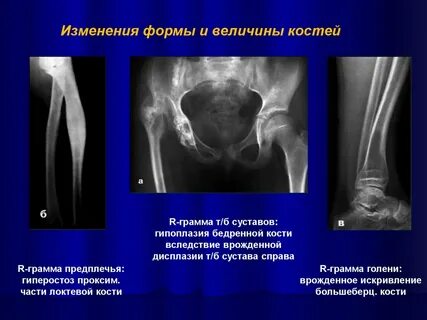 Величины кости