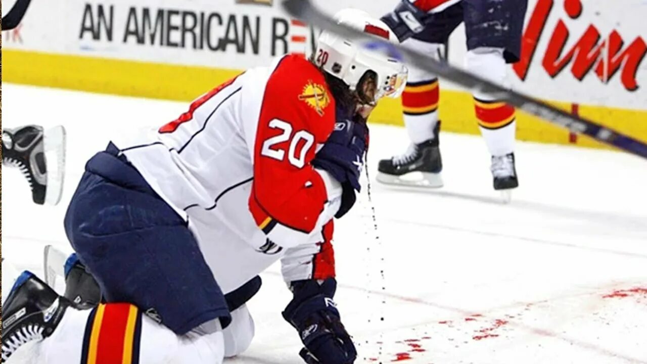 Worst injuries