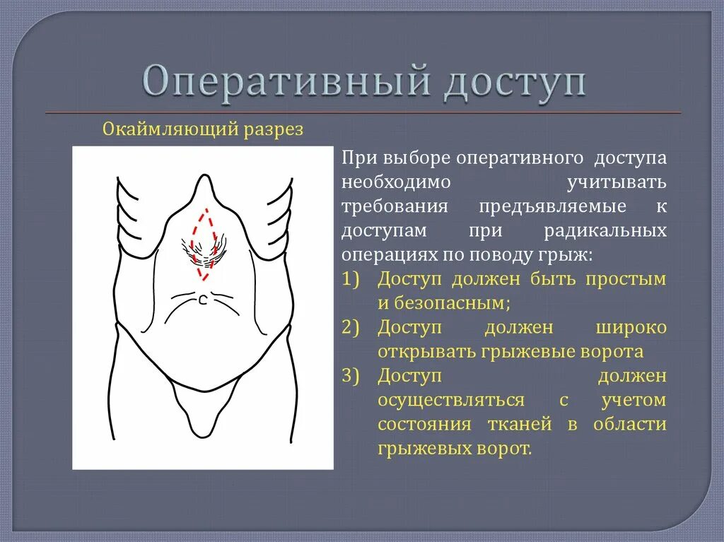 Оперативные доступы при грыжесечении. Оперативный доступ при грыжах.