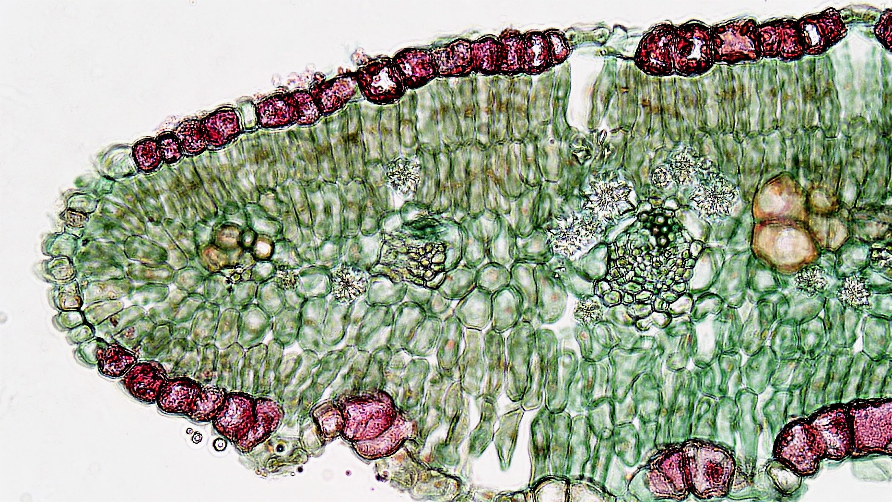 Водоносные клетки в листьях имеет. Водоносная паренхима под микроскопом. Водоносная паренхима алоэ. Водоносная ткань. Водоносная ткань растений.