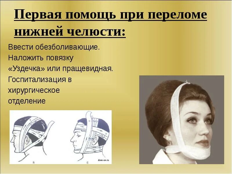 Повязка при повреждении подбородка. Пращевидная повязка при переломе верхней челюсти. повязка при переломе нижней челюсти. пращевидная повязка при переломе нижней челюсти. фиксирующая повязка на нижнюю челюсть.