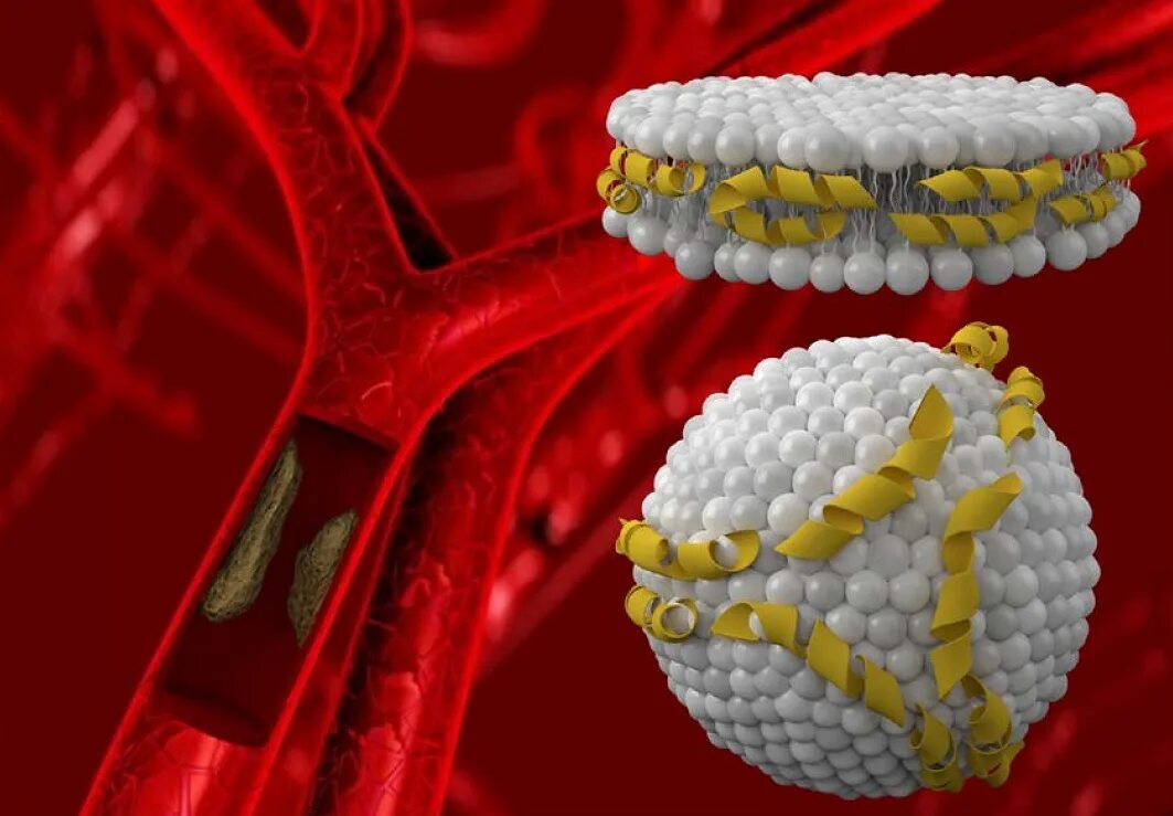 Пониженный холестерин лпвп в крови. Липопротеины. Липопротеины под микроскопом. Молекула холестерина. Липопротеины заболевания.