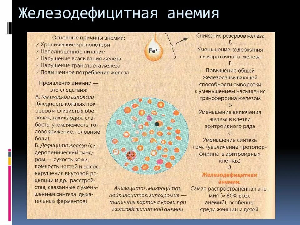 Железодефицитная анемия наблюдается при. Железо крови при железодефицитной анемии. Алиментарная анемия симптомы. Симтомы Анимия железодефицитная анемия. Железо-дифецитная Анимия.