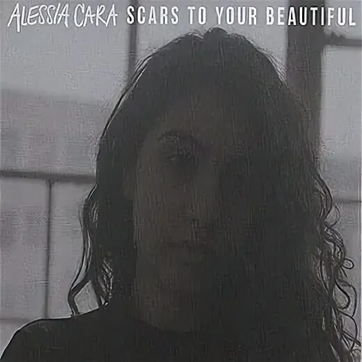 Alessia cara scars