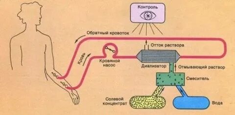 Обратный контроль