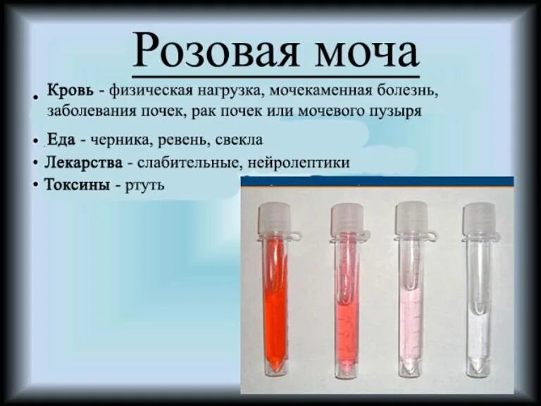 Почему краснеет моча. Розовая моча. розовая моча после свеклы. моча розового цвета. розово-красный цвет мочи.