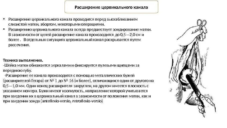 Атрезия наружного зева шейки матки. Сращение цервикального канала что это. Стриктура наружного зева цервикального канала. Стеноз цервикального канала протокол. Матка увеличена причины при осмотре у гинеколога