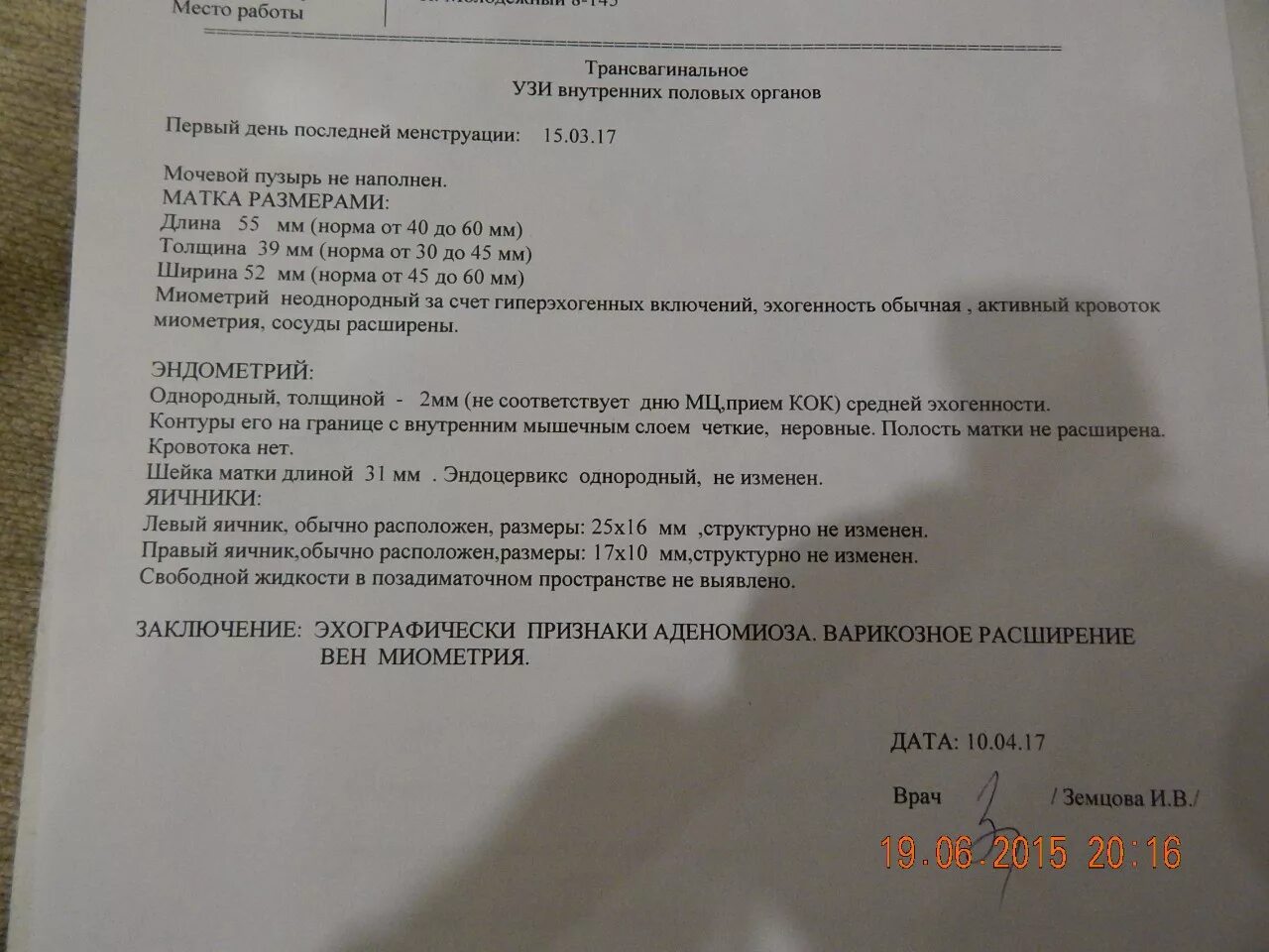 Матка 37 мм. Ультразвуковое исследование матки УЗИ норма. Эндометрий при беременности по УЗИ. Размеры матки в норме по УЗИ. Размеры матки на УЗИ норма.