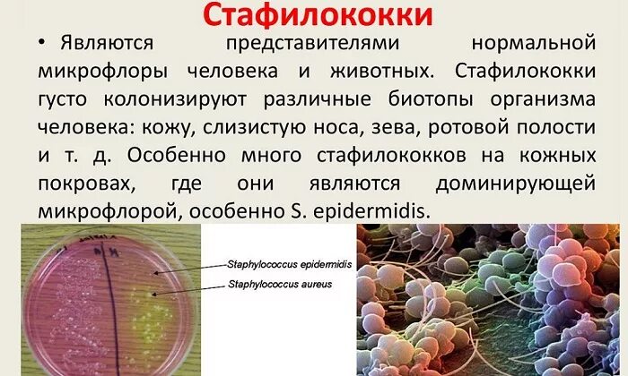 Стафилококковая инфекция. Стафилококк передается. Стафилококковые инфекции передаются. Стафилококковая инфекция пути передачи.