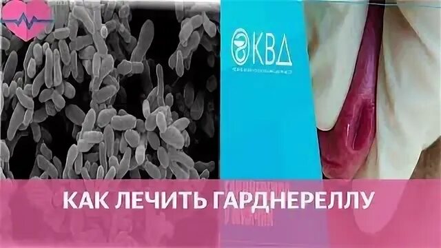 Gardnerella у мужчин лечить. Микоплазмоз гениталиум. Gardnerella у мужчин лечить. Gardnerella у мужчин лечить. Gardnerella у мужчин лечить.