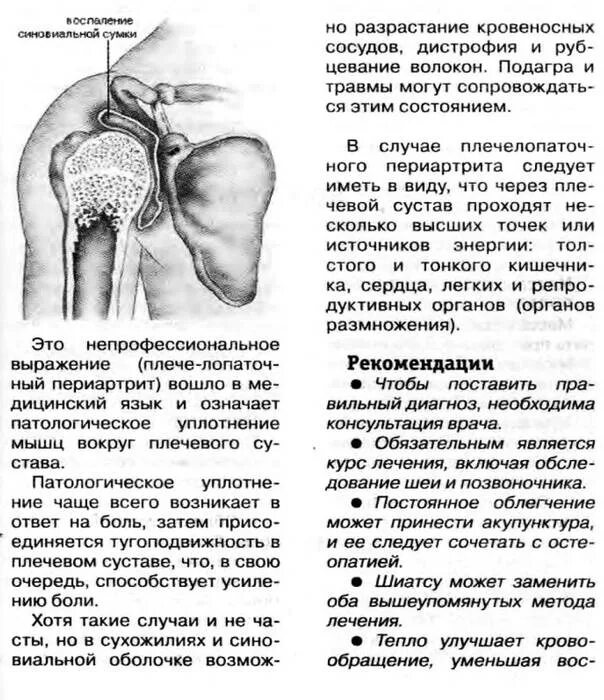 Болят плечевые суставы причины. Болят плечевые суставы причины