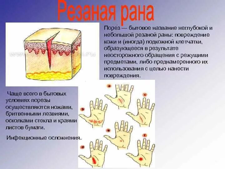 Слизистые покровы или гладкая поверхность мелкие