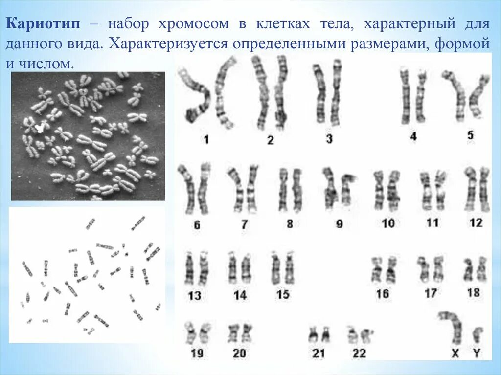 Кариотип человека определяют