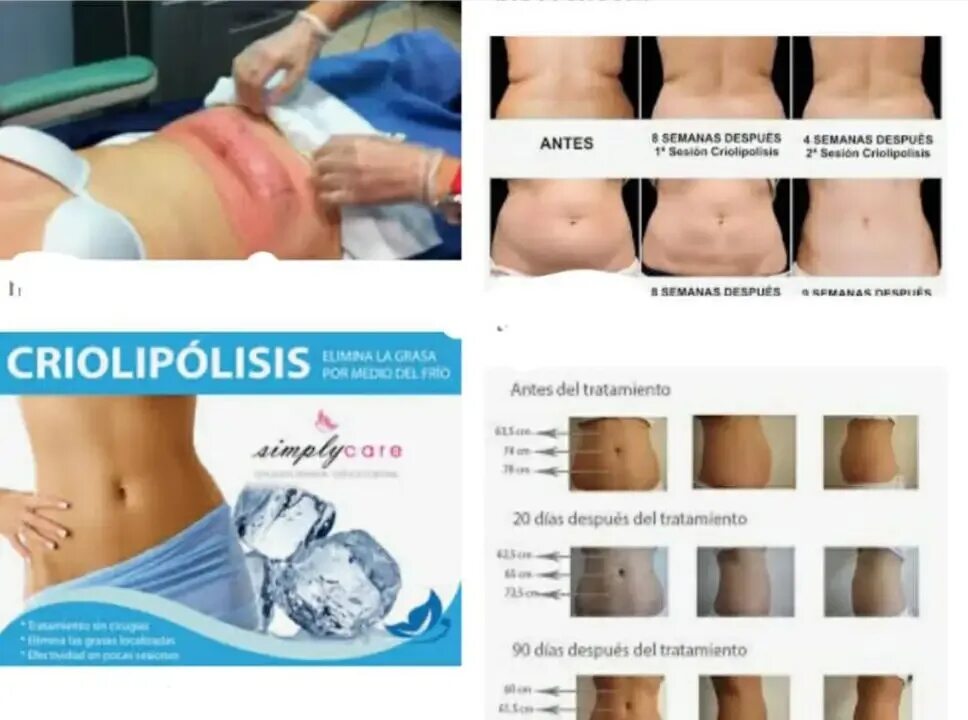 Panorama: Body-Line Lpg массаж, massage salon, Maykop, Proletarskaya Street, 258