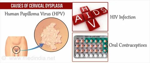 Гинекологиялық айнамен ішінен писканың фотосы