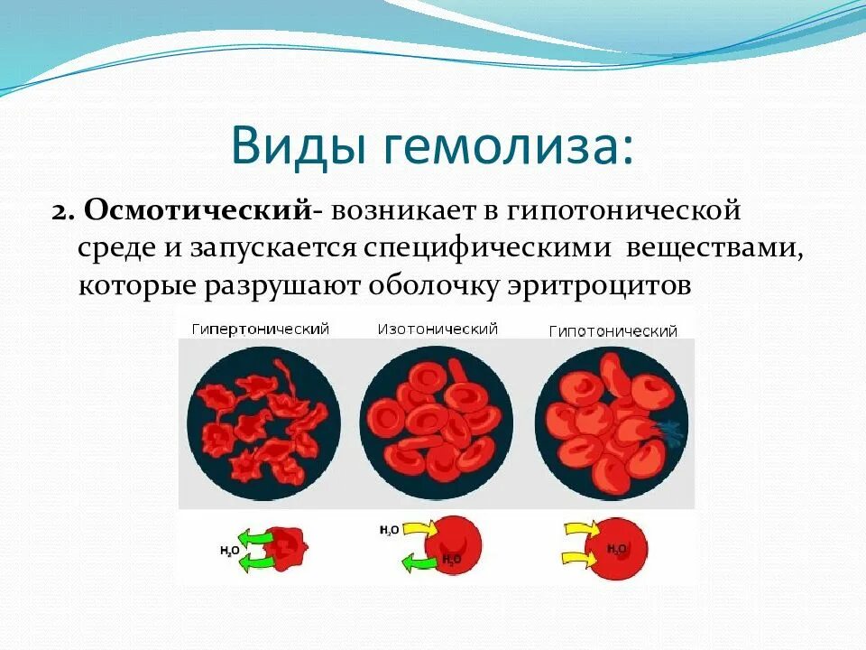 Осмотический гемолиз эритроцитов. Причины осмотического гемолиза эритроцитов. Механизм гемолиза эритроцитов. Осмотическая устойчивость эритроцитов. Эритроциты в растворе хлорида натрия