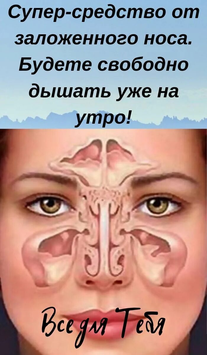 Сильно заложило. Супер-средство от заложенного носа. От заложенность носа. Избавление от заложенности носа.