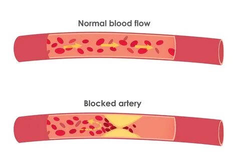 Blood flow