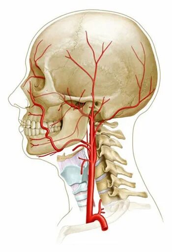Аневризма сонной артерии что это. Аневризма сонной артерии. Аневризма внутренней сонной артерии шеи. Наружная Сонная артерия анатомия.