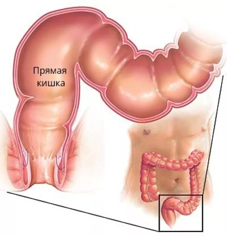 Анатомия кишечника прямая кишка. Строение прямой кишки у человека. Строение прямой кишки анатомия. Расширив проход
