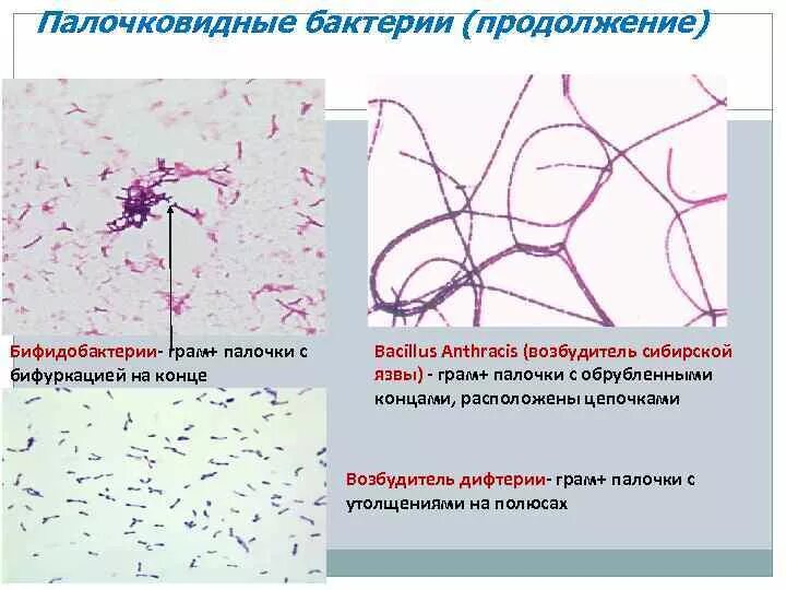 Палочковые формы бактерий. Палочковые формы бактерий. Палочковидочные баккцины. Формы клеток бактерий палочковидные. Палочковидные бактерии рисунок микробиология.