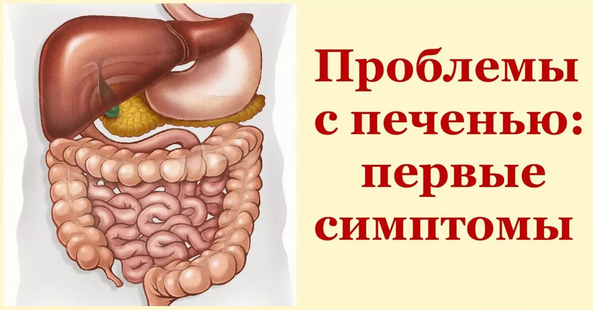 Проблемы с печенью симптомы. Пролемыс печенью. Симптомы болезни печени.