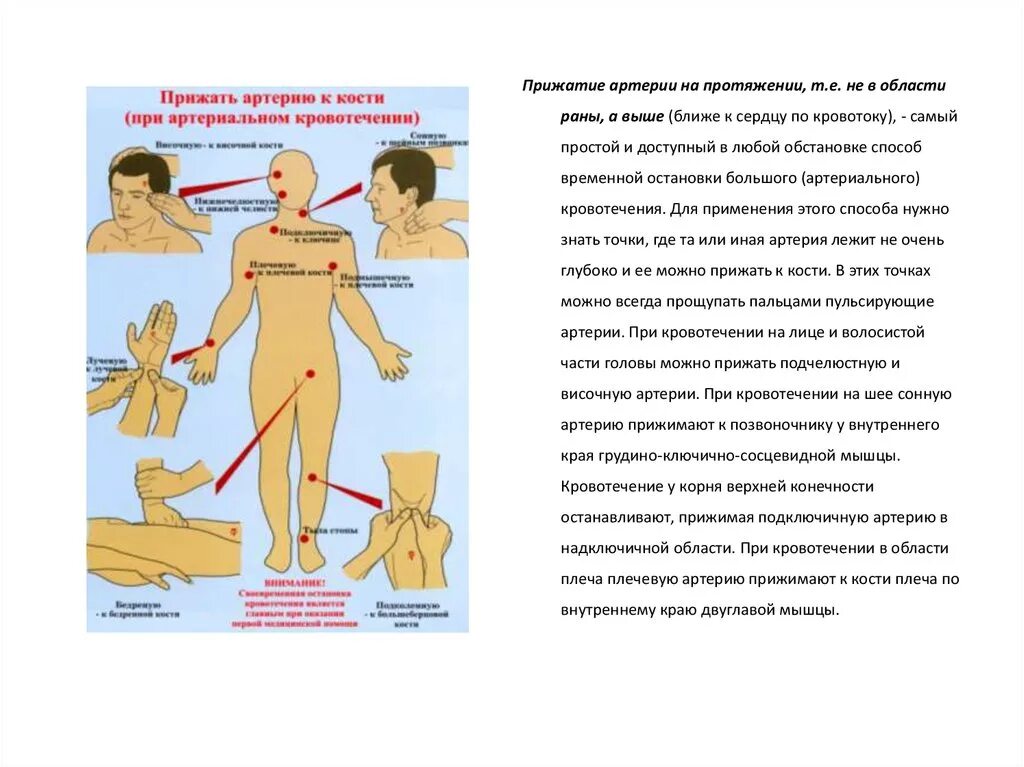 Остановить кровотечение на сонной артерии ответ тест. Кровотечения прижатие артерий. Прижатие артерий при кровотечениях. При кровотечении сонную артерию прижимают. Прижатие общей сонной артерии при кровотечении.