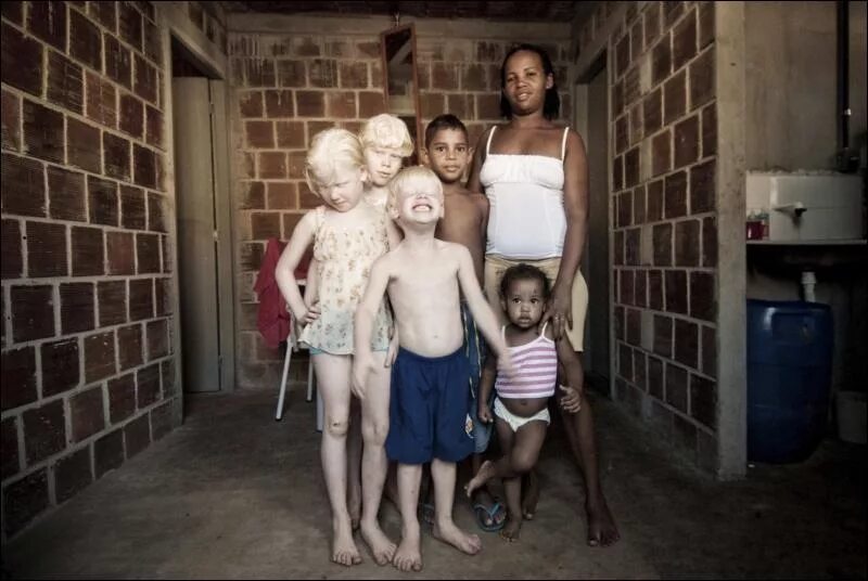 Как люди рождаются альбиносами. Необычные дети. Самые необычные семьи в мире. Самые странные семьи.