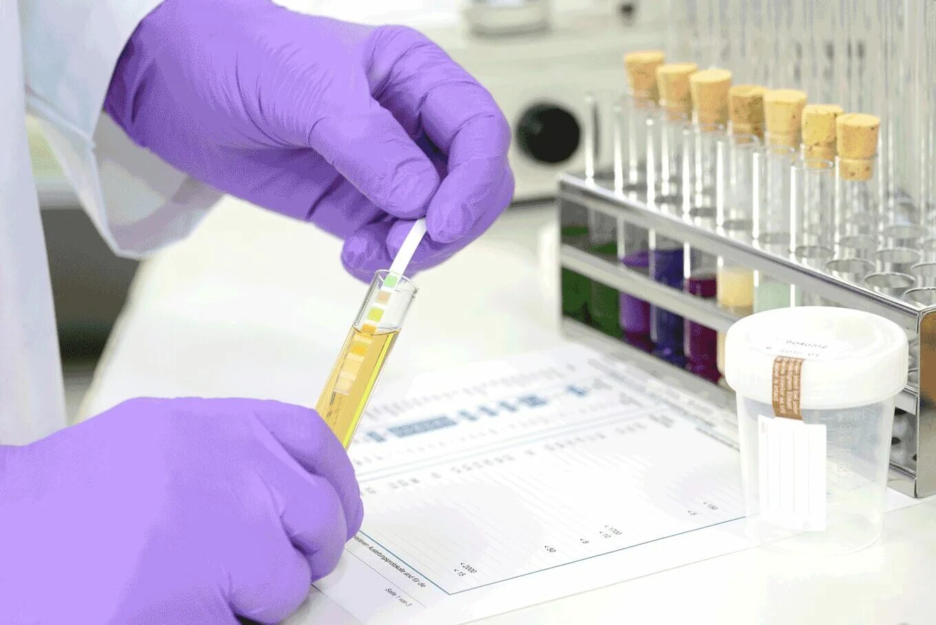 Drug Testing. Drug Screening. Drug Testing Laboratory. Urine drug Testing. Test requires new