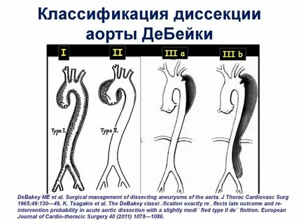 3 б тип