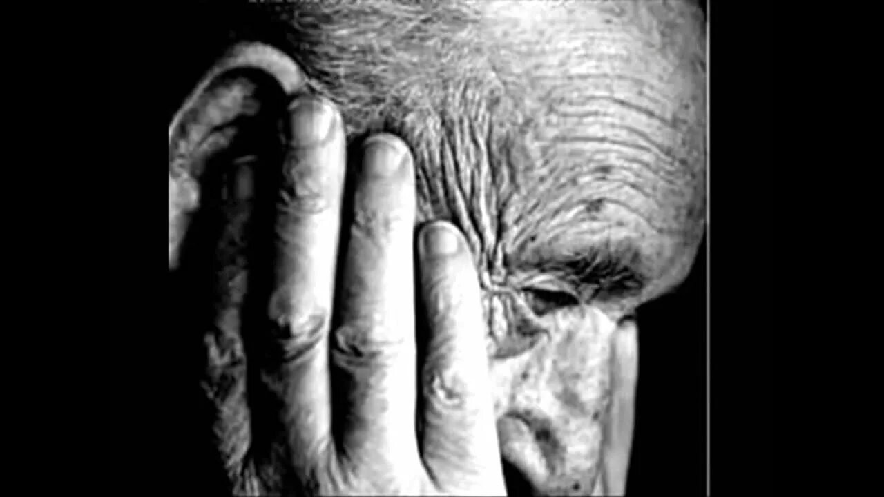 Картинки Альцгеймера. Альцгеймеровское лицо. Старческая агрессия.