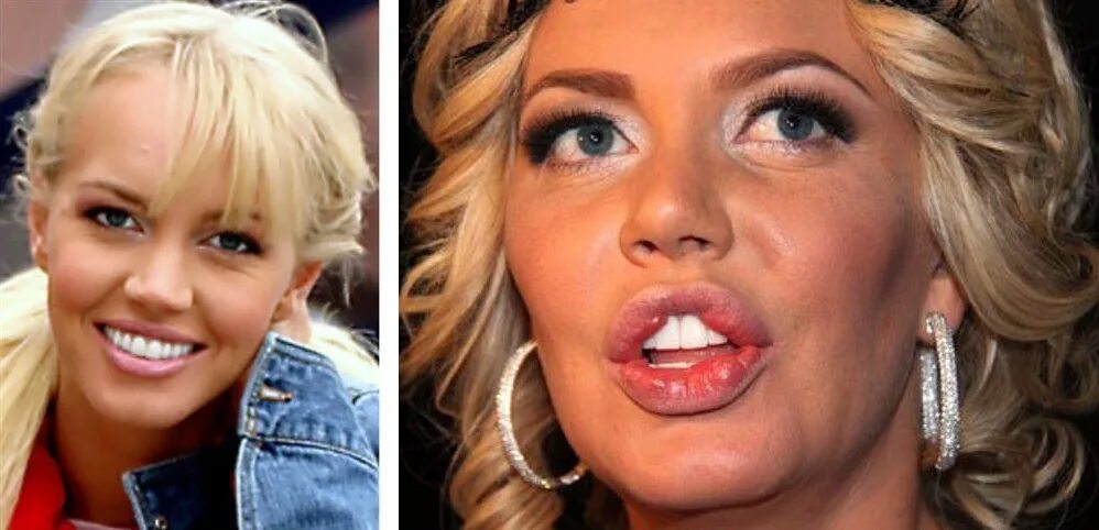 Pin on Plastic Surgery