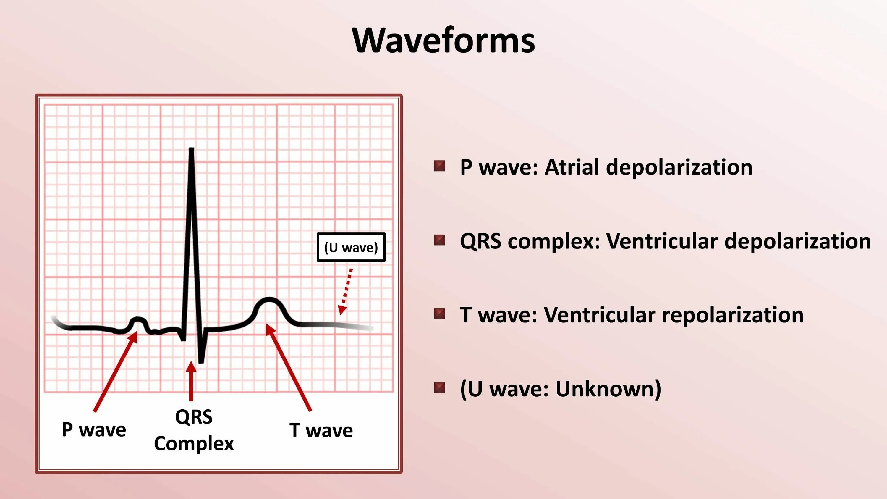 Патологический qrs. Экг pqrst. pqrst кардиограмма. комплекс qrs. комплекс pqrst.