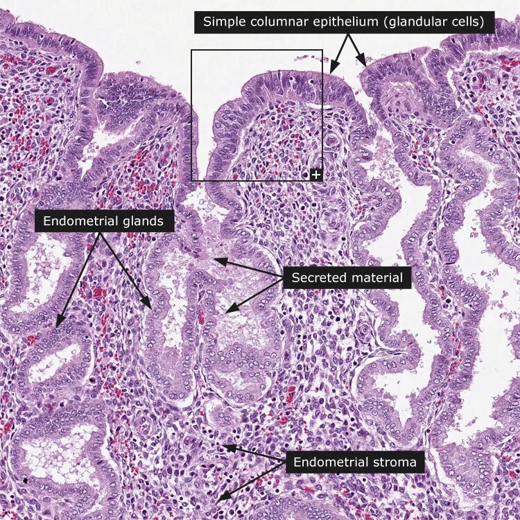 Эпителий шейки матки гистология строение. Эпителий шейки матки норма гистология. Нормальное строение шейки матки гистология. Железы шейки матки гистология. Эндометрий базальный слой