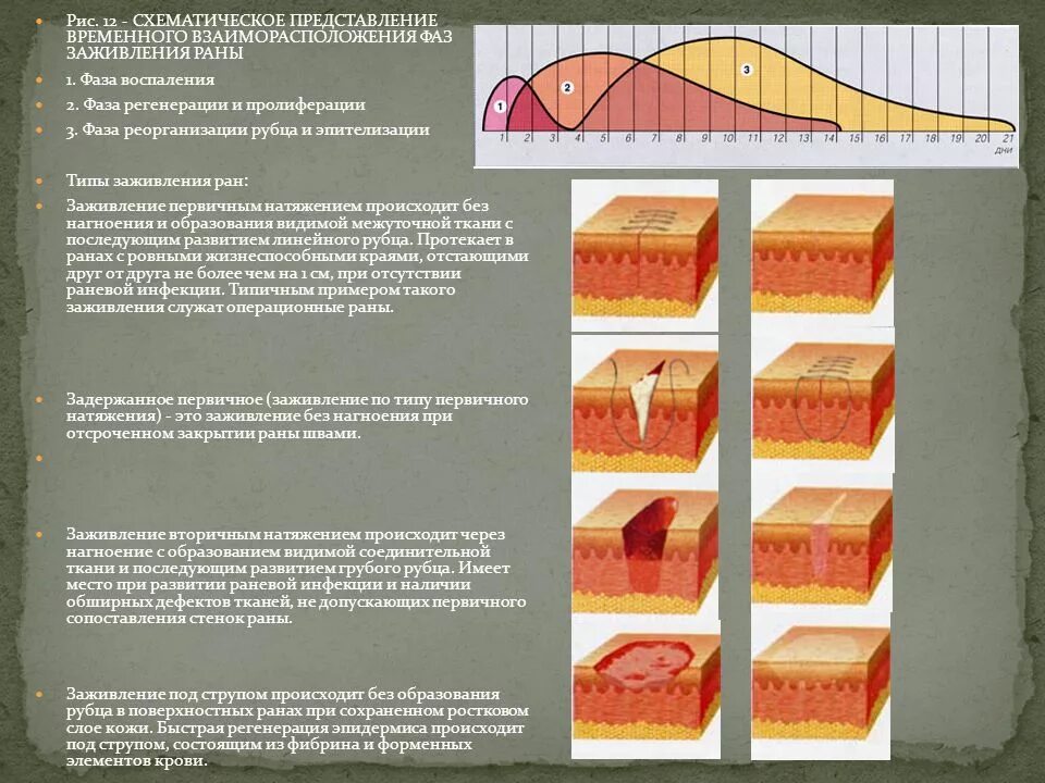 Через сколько заживает рана. Заживление РАН. Фазы заживления РАН. Фазы раневого процесса. Типы заживления РАН..