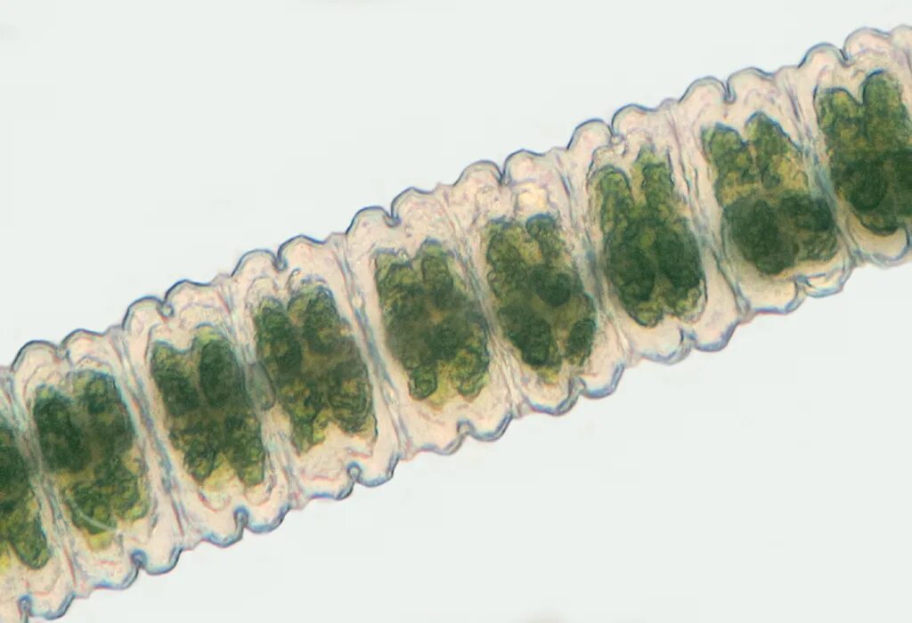 Клеточная перетяжка у каких клеток. Desmidium swartzii. Десмидиум водоросль под микроскопом. Мужоция. Зигнема.
