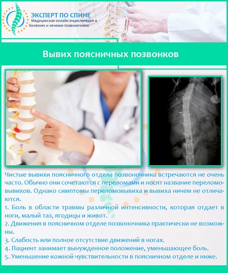 Смещение в поясничном отделе. Вывих поясничного позвонка. вывих поясничных позвонков. вывих позвоночника в поясничном отделе симптомы. растяжение связок спины поясничного отдела.