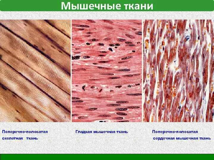 Строение поперечно полосатой мышечной ткани под микроскопом. Поперечно Скелетная мышечная ткань. Скелетная сердечная и гладкая мышечная ткань. Поперечная мышечная ткань микропрепарат.