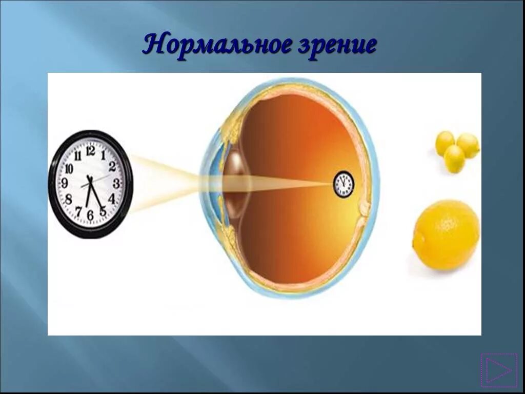 Зрение 9 10. Зрение -9. Нормальное зрение. Зрение минус 9. Нормальное зрение у человека.