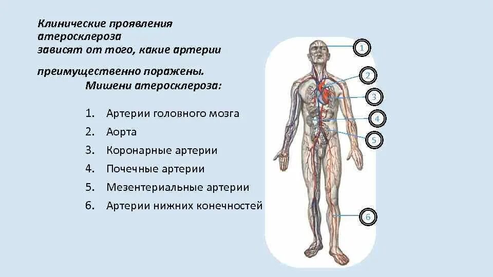 Симптомы зажатых сосудов. Клинические симптомы атеросклероза. основные локализации атеросклеротического поражения сосудов. атеросклероз клинические проявления в зависимости от локализации. основные клинические симптомы атеросклероза.