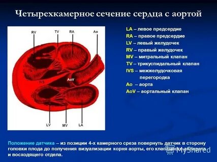 Поперечный срез четырехкамерного сердца