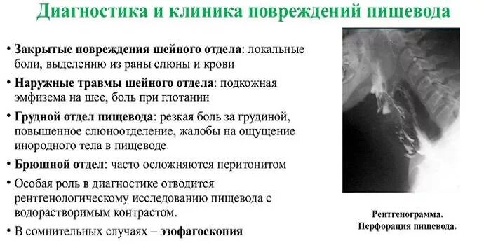 Болит правая сторона при глотании. Болит пищевод при глотании в грудной клетке. боль за грудиной при глотании. при глотании болит в грудной клетке. при глотании пищи больно в грудной клетке.