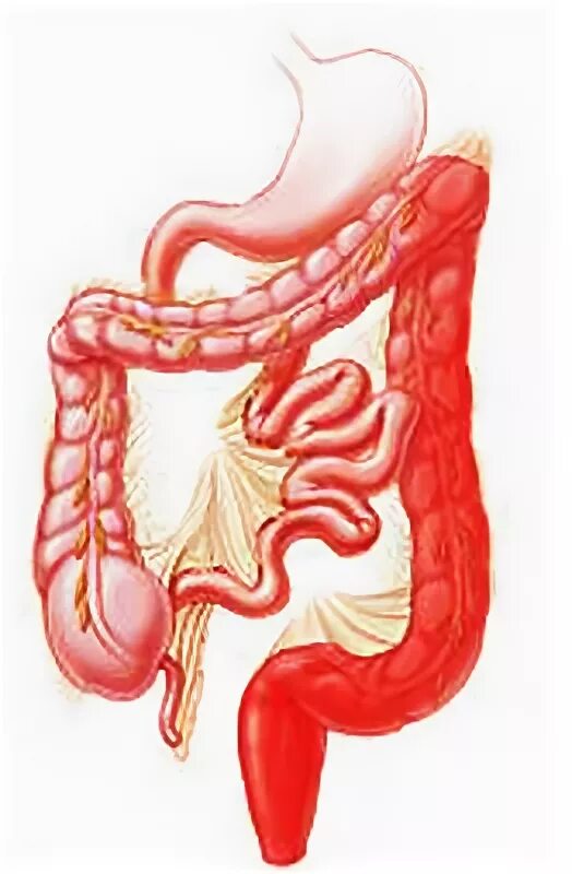 Боль в спине. Колет внутри. Эрозированный язвенный колит. Хронический неспецифический энтерит и колит. Язвенный колит толстой кишки.
