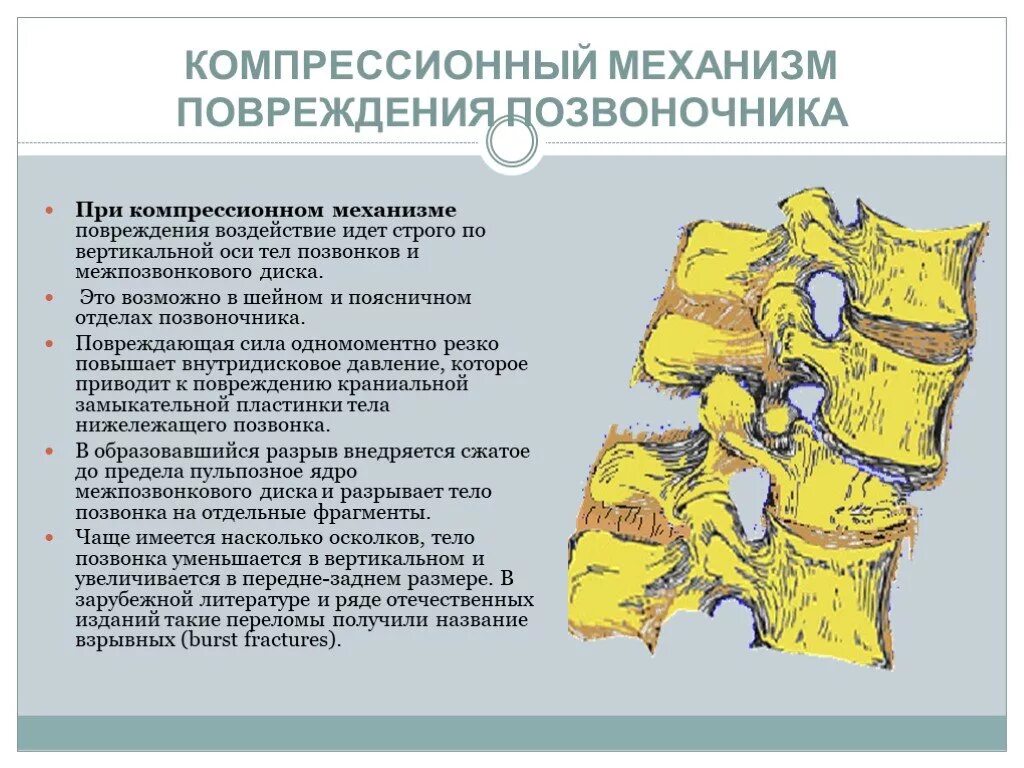 Механизм компрессионного перелома позвоночника. Механизмы травмы при переломах позвоночника. Компрессионный перелом механизм травмы. Компрессионный перелом позвоночника степень тяжести травмы.