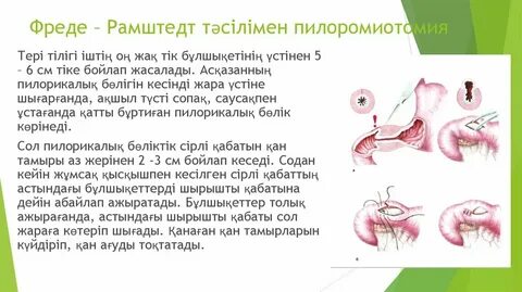 Кесілген фото слайдтар