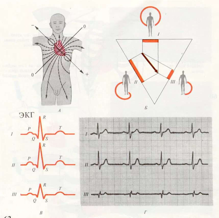 1 Стандартное отведение ЭКГ. Методика отведения в ЭКГ. Электрокардиограмма. Способы отведения ЭКГ.. Грудные отведения ЭКГ стенки сердца. В каких условиях необходимо проводить исследование экг